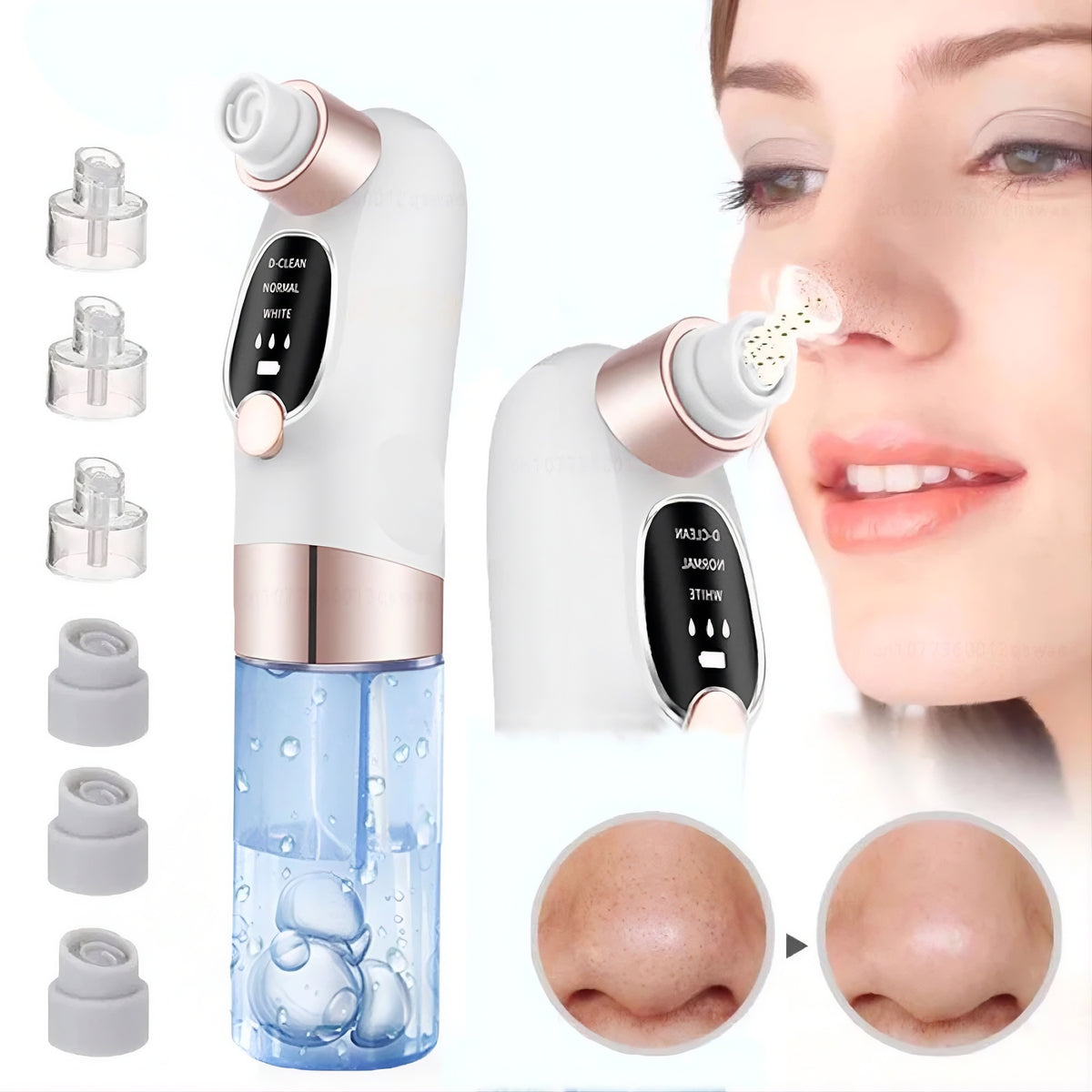 Pore Vacuum Blackhead Remover