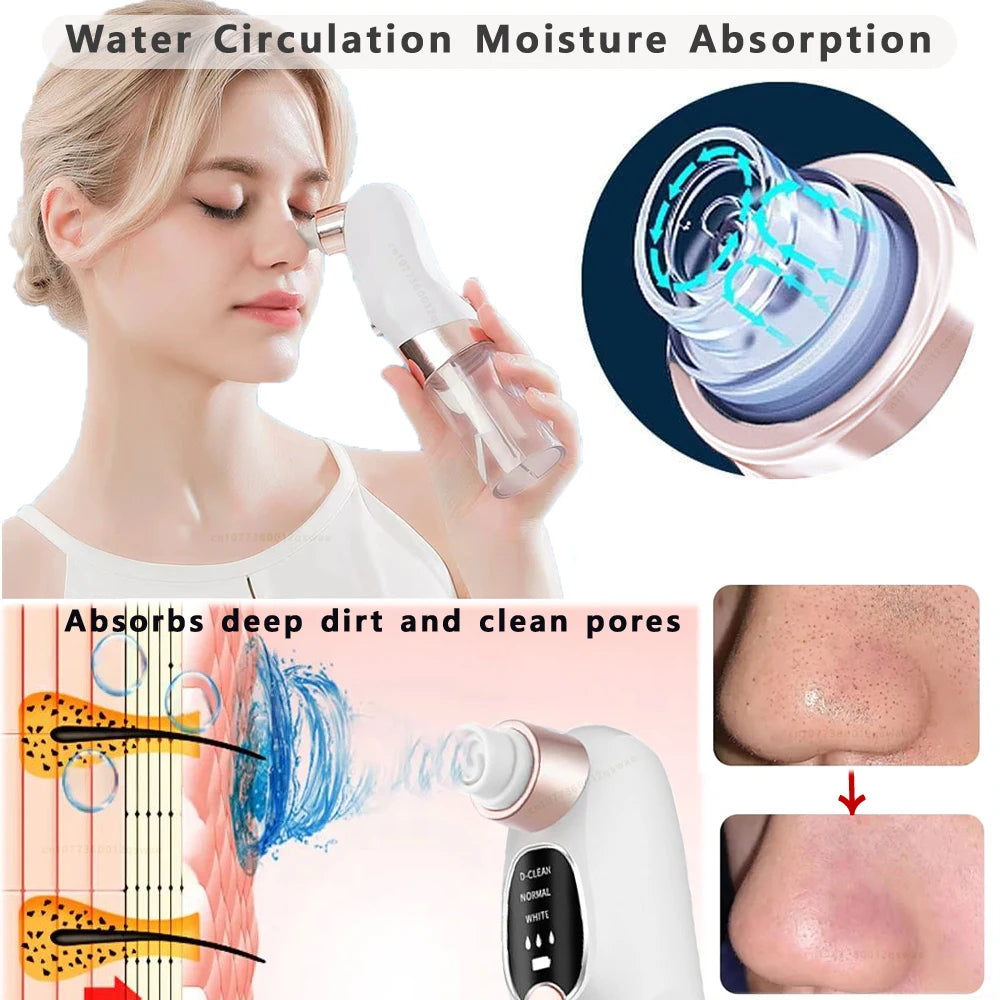 Pore Vacuum Blackhead Remover