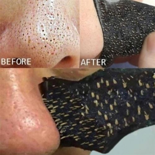 Deep-Clean Pore Strips