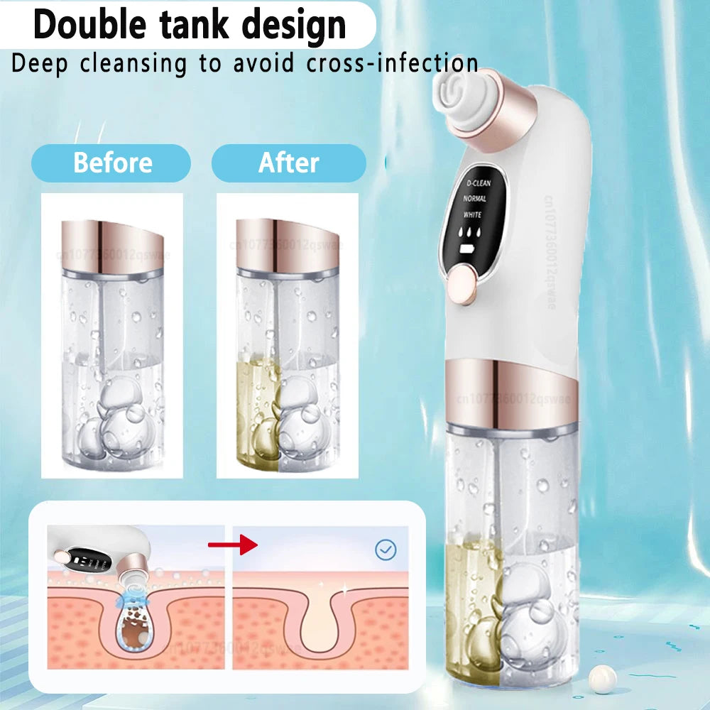 Pore Vacuum Blackhead Remover