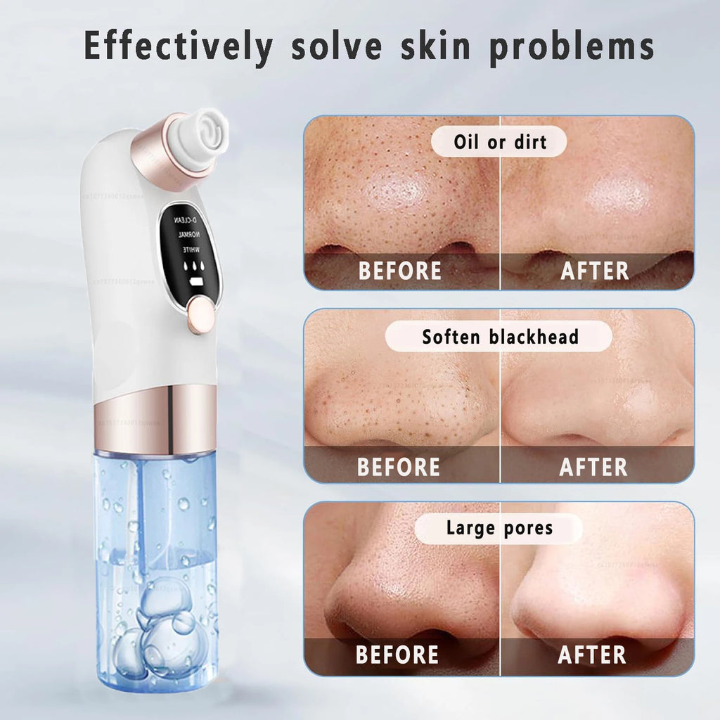 Pore Vacuum Blackhead Remover
