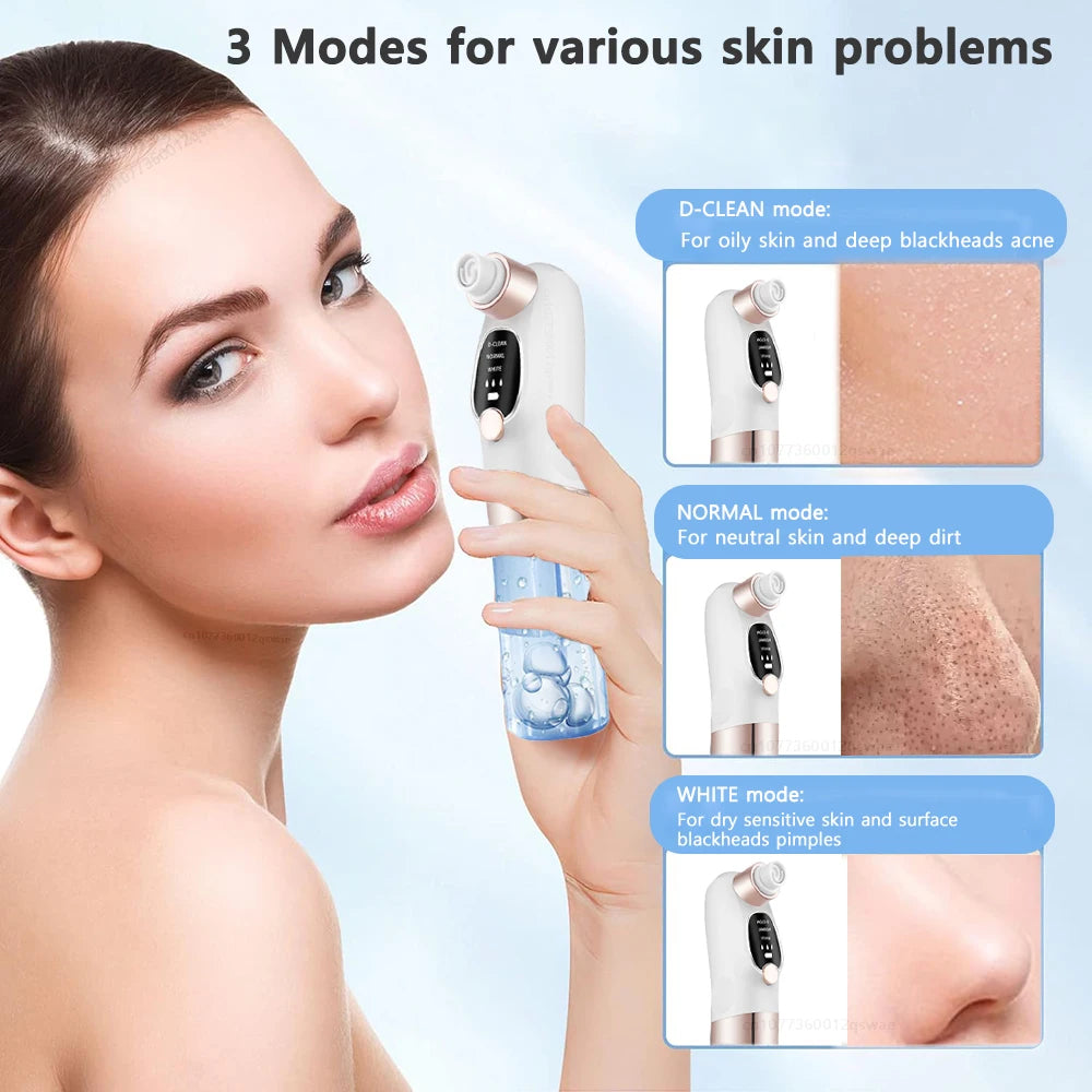 Pore Vacuum Blackhead Remover